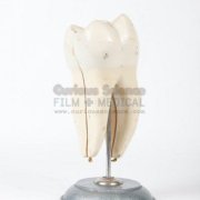 Dental Models